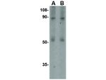 TEM1 Antibody in Western Blot (WB)