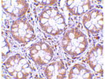 TEM2 Antibody in Immunohistochemistry (Paraffin) (IHC (P))