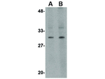 TEM2 Antibody in Western Blot (WB)