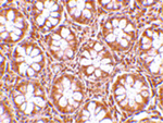 TEM2 Antibody in Immunohistochemistry (Paraffin) (IHC (P))