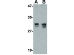 TEM2 Antibody in Western Blot (WB)