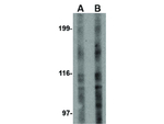 TEM4 Antibody in Western Blot (WB)
