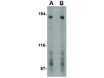 TEM5 Antibody in Western Blot (WB)