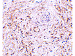 TEM5 Antibody in Immunohistochemistry (Paraffin) (IHC (P))
