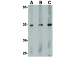 TEM7 Antibody in Western Blot (WB)