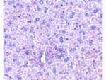 TEM7 Antibody in Immunohistochemistry (Paraffin) (IHC (P))