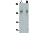 TEM7 Antibody in Western Blot (WB)