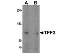TFF3 Antibody in Western Blot (WB)