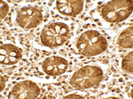 TICRR Antibody in Immunohistochemistry (Paraffin) (IHC (P))