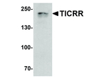 TICRR Antibody in Western Blot (WB)