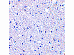 TIGAR Polyclonal Antibody
