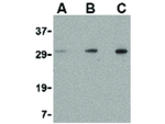 TIGAR Antibody in Western Blot (WB)