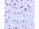 TIGAR Antibody in Immunohistochemistry (Paraffin) (IHC (P))