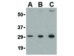 TIGAR Antibody in Western Blot (WB)
