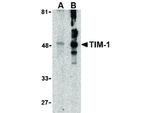 TIM-1 Antibody in Western Blot (WB)