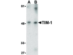 TIM-1 Polyclonal Antibody