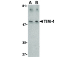 TIM-4 Polyclonal Antibody