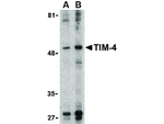 TIM-4 Antibody in Western Blot (WB)