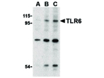 TLR6 Antibody in Western Blot (WB)