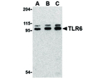 TLR6 Antibody in Western Blot (WB)