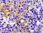 TLR9 Antibody in Immunohistochemistry (Paraffin) (IHC (P))