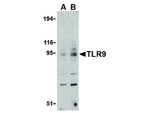TLR9 Antibody in Western Blot (WB)