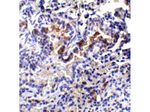TM4SF1 Antibody in Immunohistochemistry (Paraffin) (IHC (P))