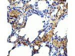 TM4SF1 Antibody in Immunohistochemistry (Paraffin) (IHC (P))