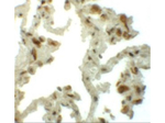 TM4SF1 Antibody in Immunohistochemistry (Paraffin) (IHC (P))