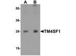TM4SF1 Antibody in Western Blot (WB)