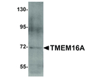 TMEM16A Polyclonal Antibody