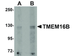 TMEM16B Antibody in Western Blot (WB)
