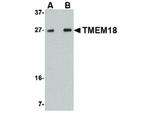 TMEM18 Antibody in Western Blot (WB)