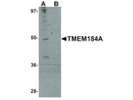 TMEM184A Antibody in Western Blot (WB)