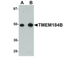TMEM184B Antibody in Western Blot (WB)