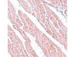 TMEM184C Antibody in Immunohistochemistry (Paraffin) (IHC (P))