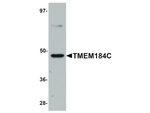 TMEM184C Antibody in Western Blot (WB)