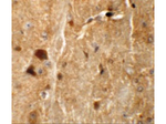 TMEM192 Antibody in Immunohistochemistry (Paraffin) (IHC (P))