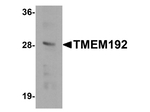 TMEM192 Antibody in Western Blot (WB)
