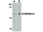TMEM214 Antibody in Western Blot (WB)