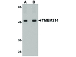 TMEM214 Polyclonal Antibody