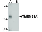 TMEM38A Antibody in Western Blot (WB)