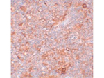 TMEM38B Antibody in Immunohistochemistry (Paraffin) (IHC (P))