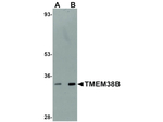 TMEM38B Antibody in Western Blot (WB)