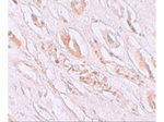 TMEM59 Polyclonal Antibody