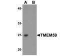 TMEM59 Antibody in Western Blot (WB)