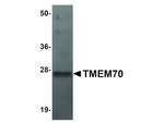TMEM70 Antibody in Western Blot (WB)