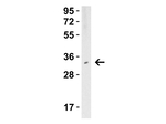 TMIGD2 Polyclonal Antibody