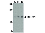TMP21 Antibody in Western Blot (WB)