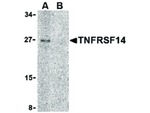 TNFRSF14 Antibody in Western Blot (WB)